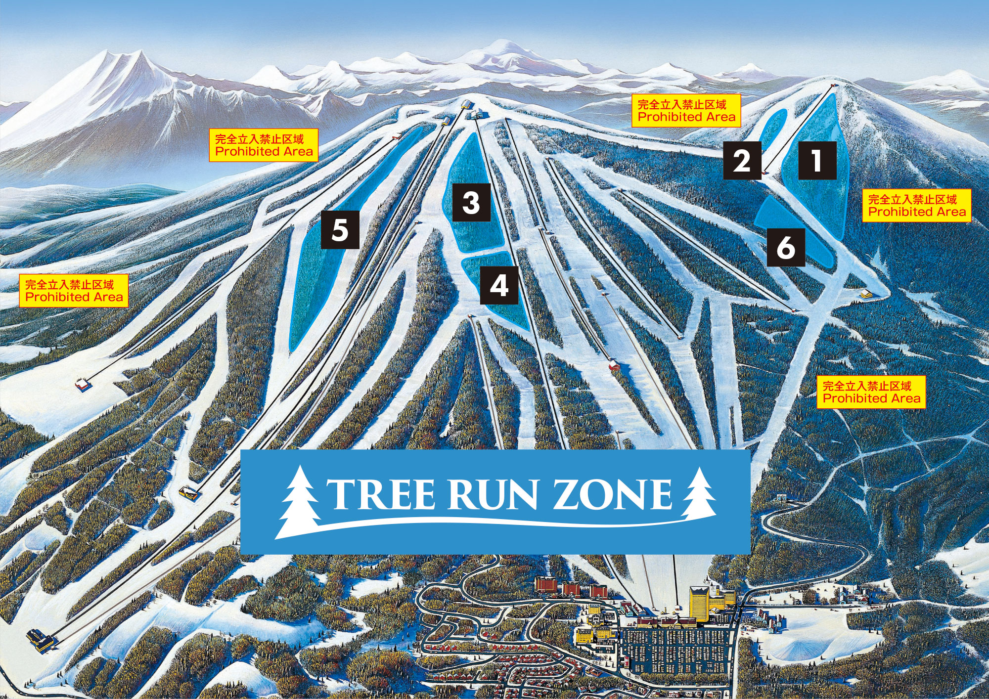 TREE RAN ZONE